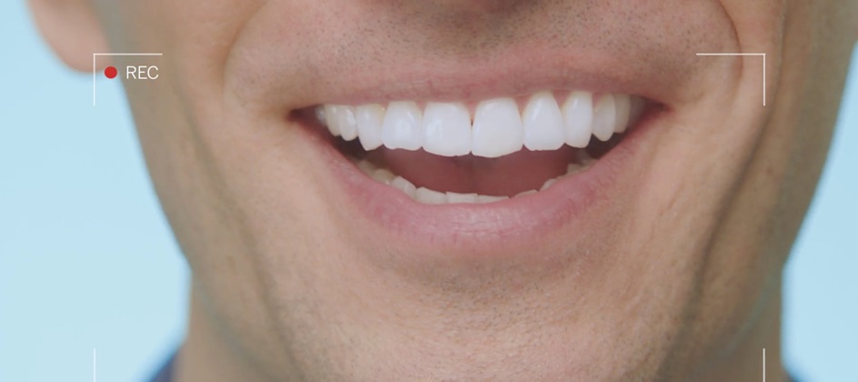 Lumineux and Yard NYC get up close and hilarious in new oral care ad spots